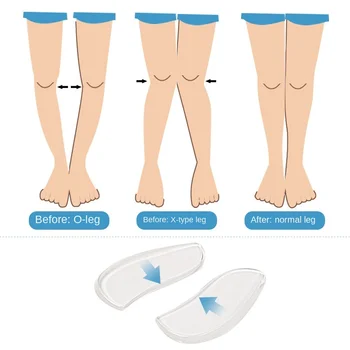 2 Buc Silicon Tălpi Orteze X/O de tip Picioarele Corectori Gel Perna Pentru Semele Ortopedice Toc Pantofi Tampoane Pentru Îngrijire de Picioare Solide
