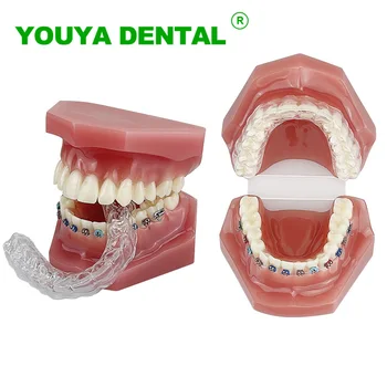 Dentare Ortodontice Dinți Model Cu Fixare Invizibil Suport Stomatologie Modelul De Predare Dentist Tratament Instrument De Demonstrație
